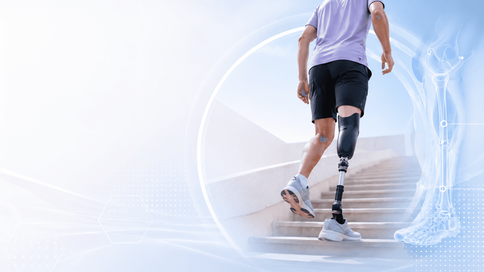 Bio-Fit patient walking with prosthetic support and clinical alignment overlay