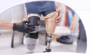 Bio-Fit prosthetic fitting and restoration support