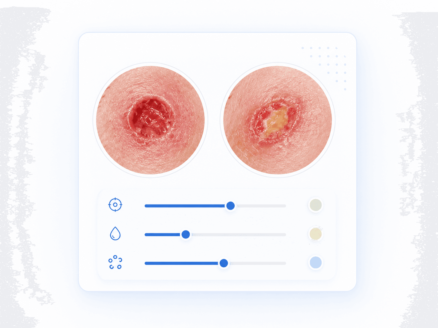 Wound assessment diagnostics visual